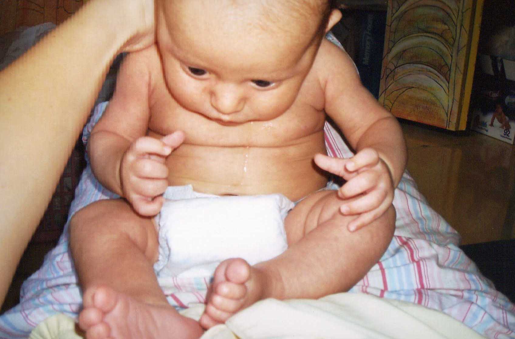 Samantha Lowry treatment to new born Sebastian Pavon Cuellar